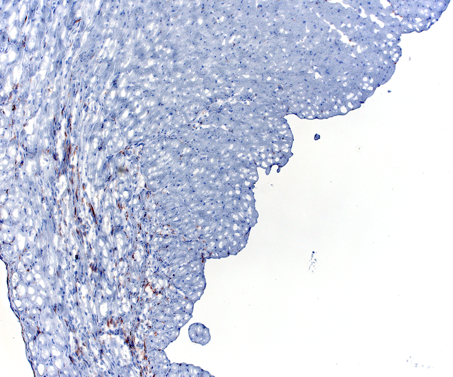 Example IHC image showing CD11b staining in brown (DAB) with hematoxylin counterstain in blue. The brown signal marks myeloid cell infiltration in cardiac tissue post-MI.