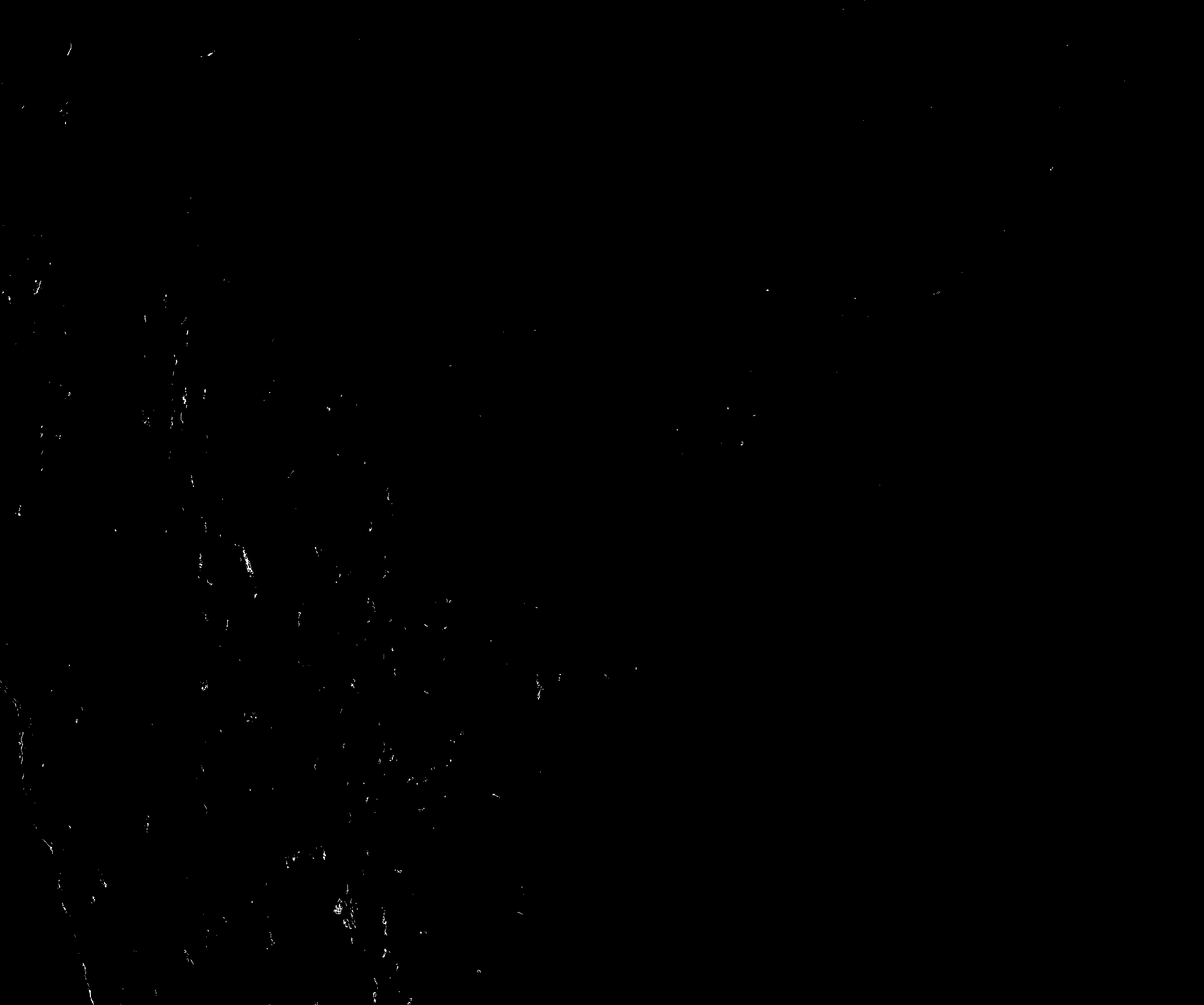 Thresholding output for IHC. Binary Otsu mask where white pixels represent DAB-positive area.